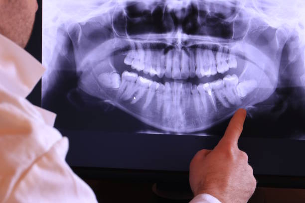 Best Pediatric Emergency Dentist in Grove City, PA